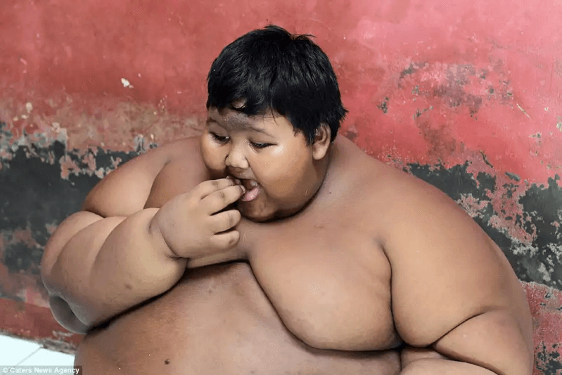 192kgの肥満児-アリヤ・ペルマナ君