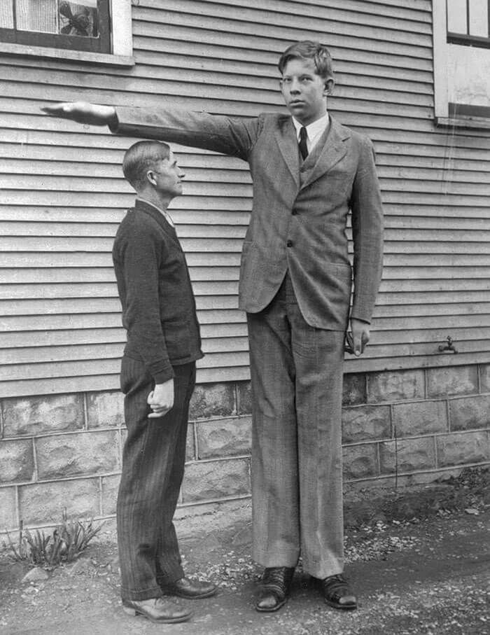 世界一身長が高い男-ロバート・ワドロー氏